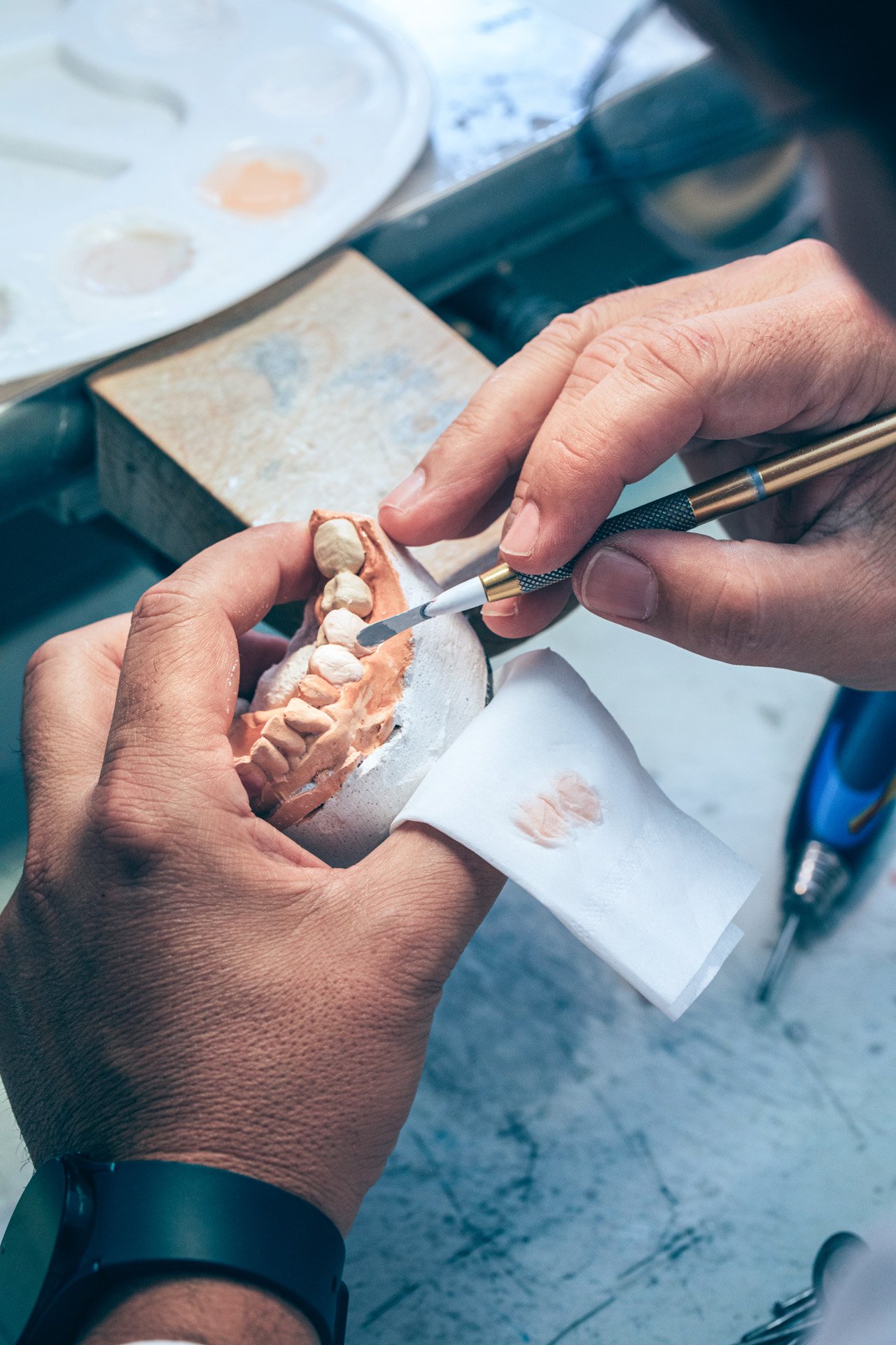 Prótesis fijas metal cerámica